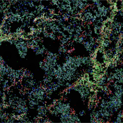 spatial biology